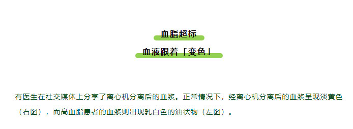 啥子，血管里流的居然不一定是血？有图有真相！